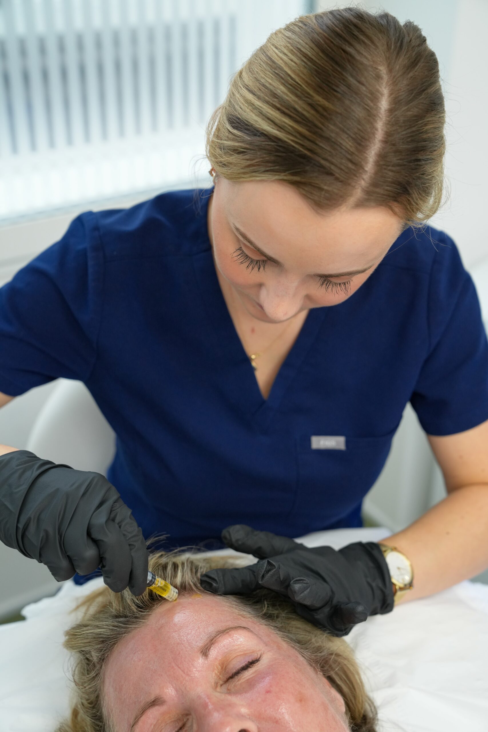 Mirconeedling Hair Restoration (1)