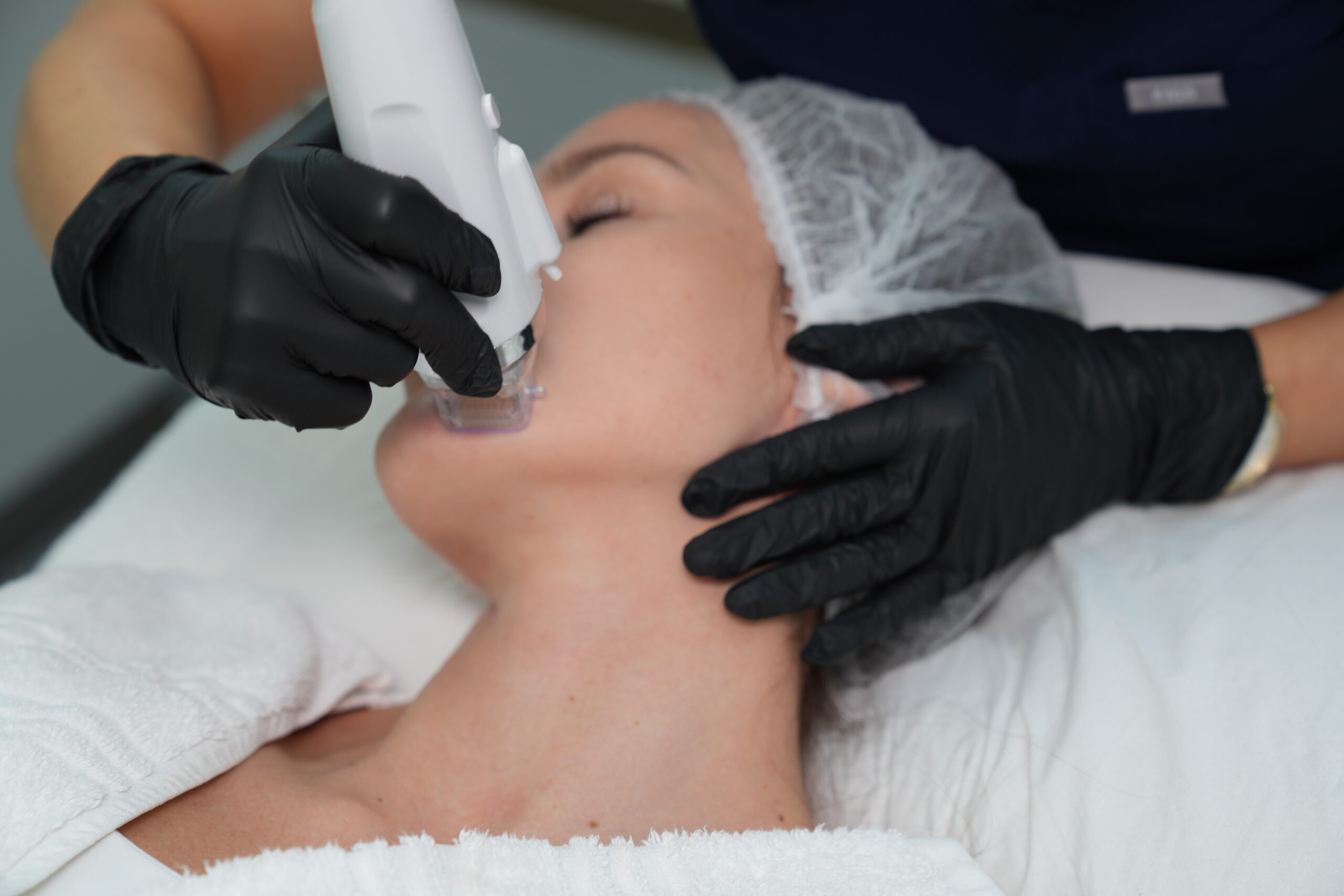 RF Microneedling X Polynucleotides (1)